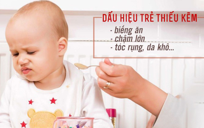 Dấu Hiệu Bé Thiếu Kẽm (04)